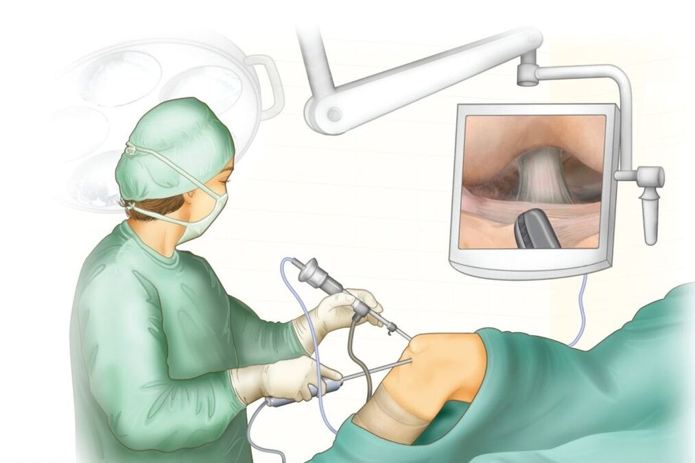 Chirurgia dell'articolazione del ginocchio