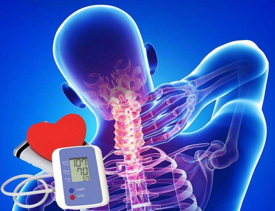 Panchina della pressione sanguigna per osteocondosi cervicale