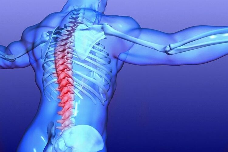 Danni alle radici del midollo spinale