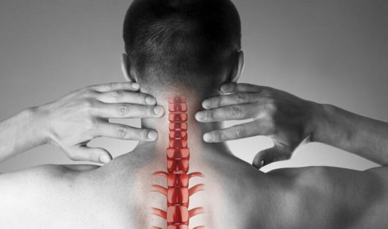 Dolore pronunciato nella sindrome neurologica
