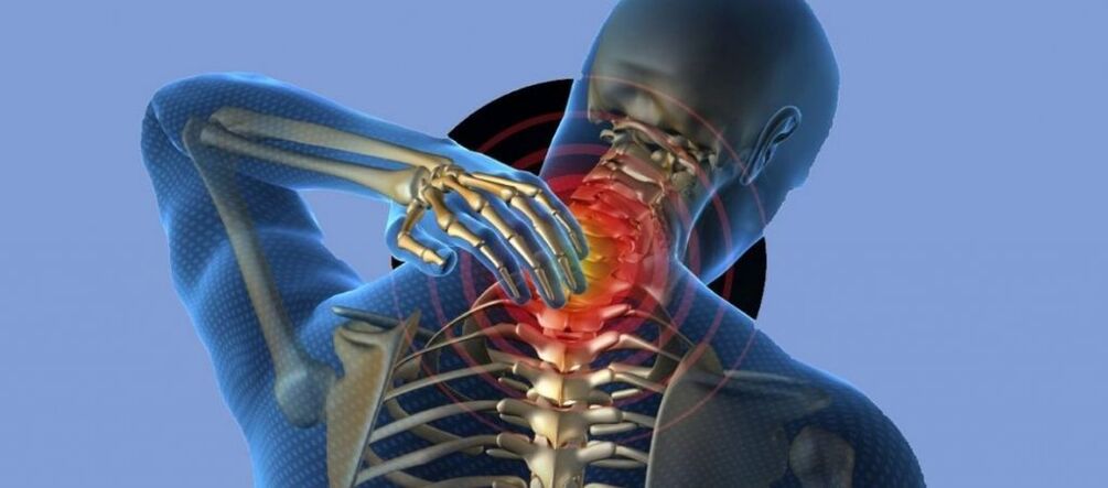 Osteocondrosi del rachide cervicale