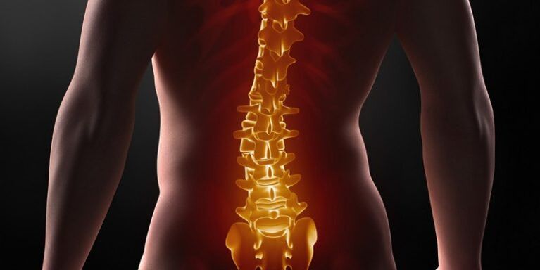 Osteocondrosi della colonna sacrale